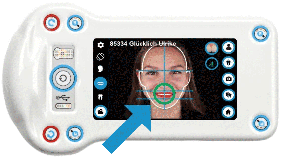 dentale-kamera-dentaleyepad-animation-vergleich-dentaleyepad-focal
