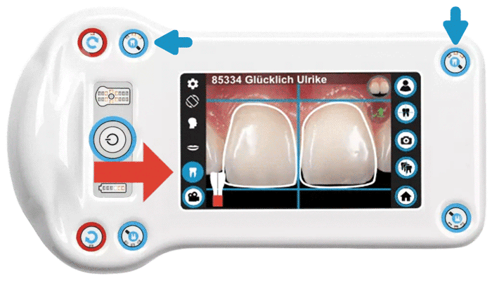 dentale-kamera-dentaleyepad-front-workflow-assistent-zoom-2