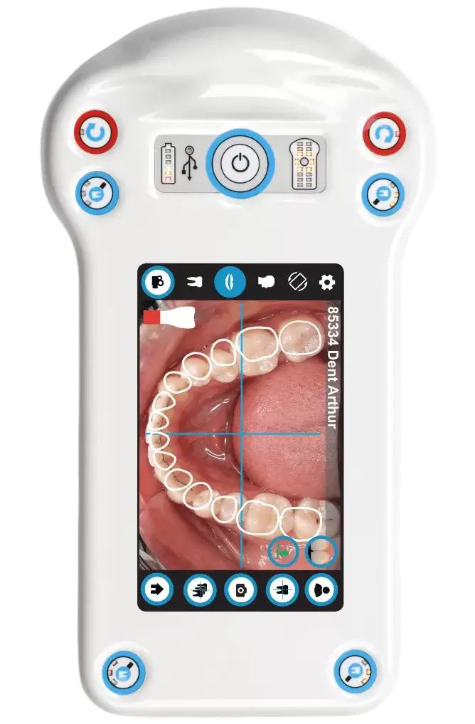 dentale-kamera-dentaleyepad-transfer-assistant-vertical-2