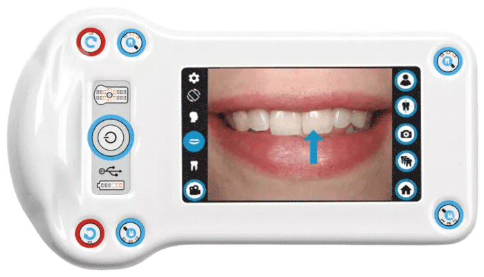 dentaleyepad-perfect-smile-assistant-1