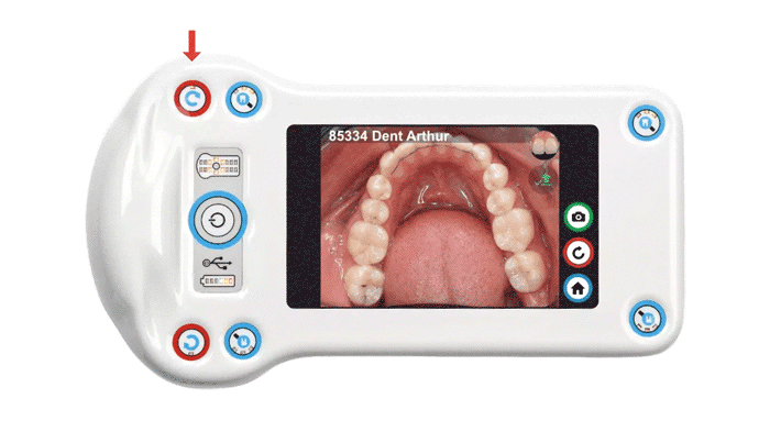 dentaleyepad-previsualisation-assistant-1